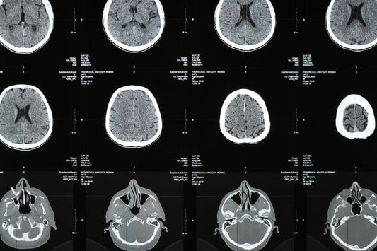 How Source Loaders Accelerate Diagnostic Capabilities in Oncology Imaging