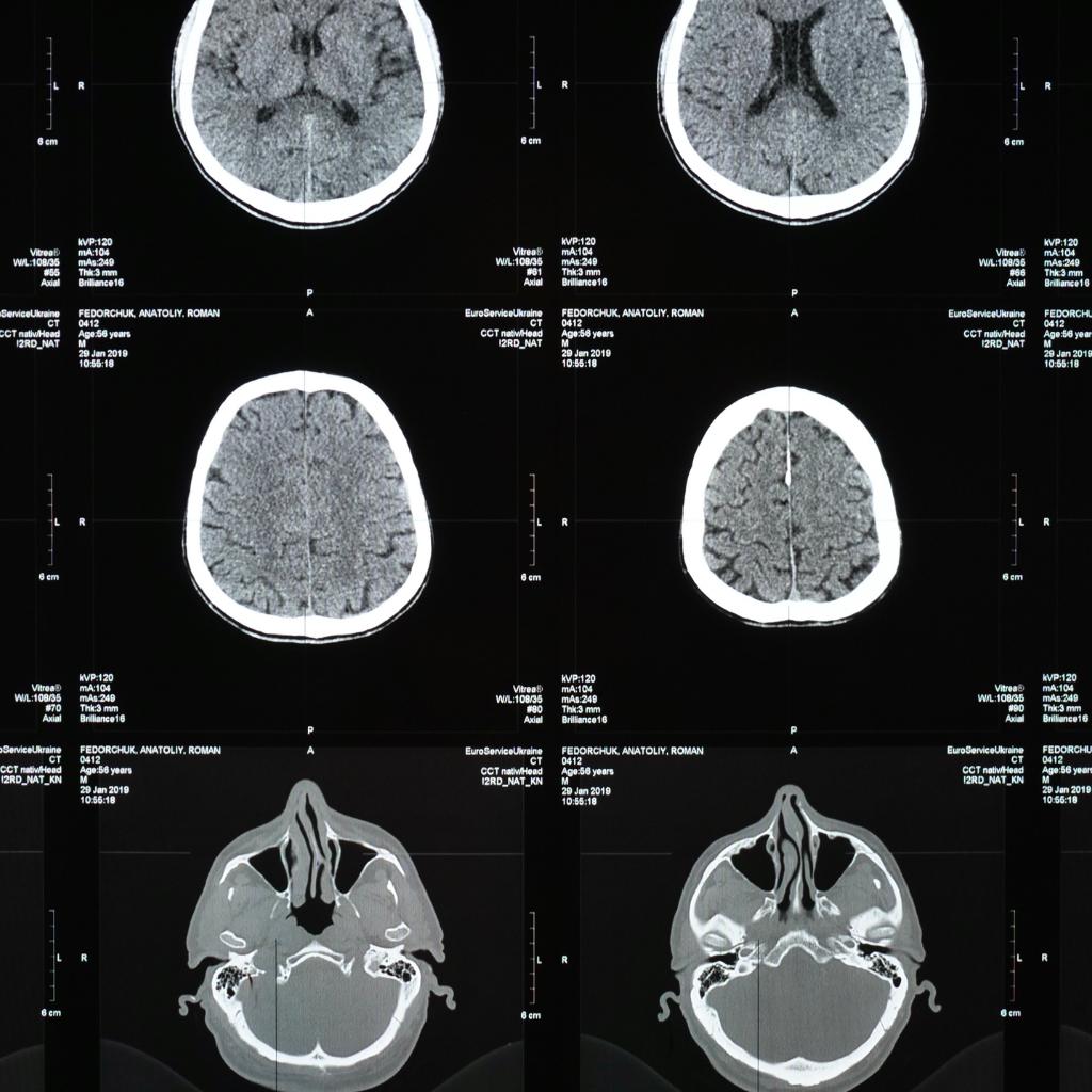 4 Key Features to Look for When Buying a Used PET Scan Machine