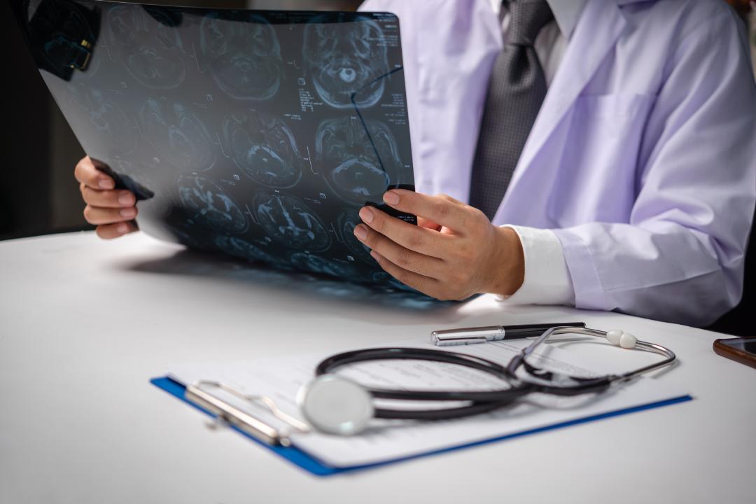 The Importance of Digital Servo Amplifiers in Medical Imaging